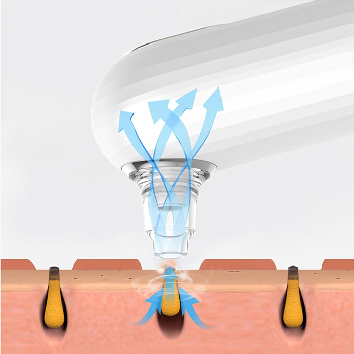Heat Blackhead Removal B9